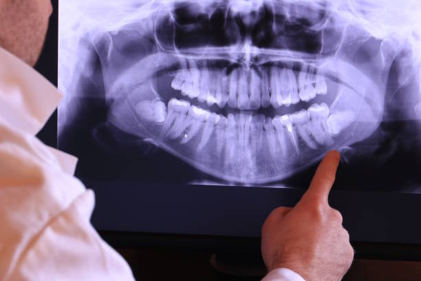 Best Pediatric Emergency Dentist in Cadott, WI